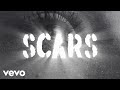 U2 - Scars
